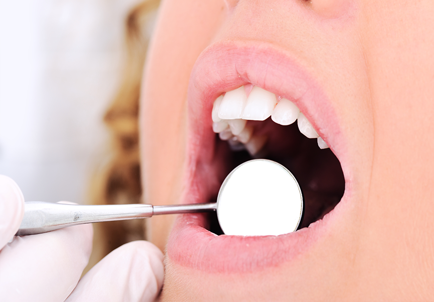Dental Treatments